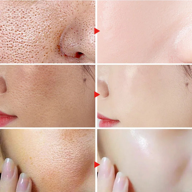 Centella Asiatica Pore Shrink Face Serum Hyaluronic Acid Moisturizing Nourish Smooth Pores Repair Essence Firm Korean Cosmetics