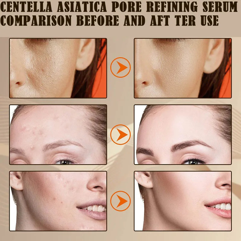 Centella Asiatica Pore Shrink Face Serum Hyaluronic Acid Moisturizing Nourish Smooth Pores Repair Essence Firm Korean Cosmetics